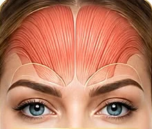 Anatomia da região frontal para estudo em Harmonização Orofacial